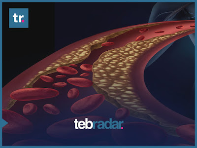 9 تجارب تساعد على خفض نسبة الكولسترول بسرعة في أسبوع