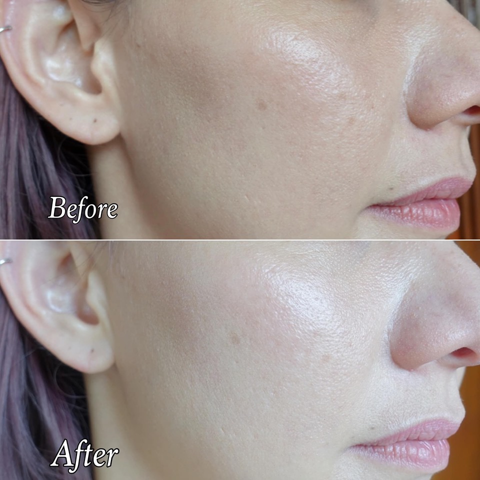 Malaysian Lifestyle Blog Murad Replenishing Multi Acid Peel Review