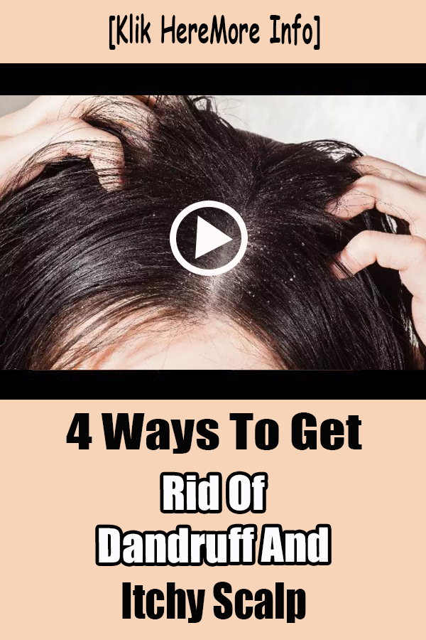 4 Ways To Get Rid Of Dandruff And Itchy Scalp thebestnaturalbeauty