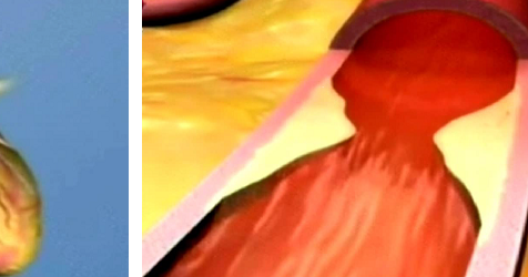 Impure blood essay image