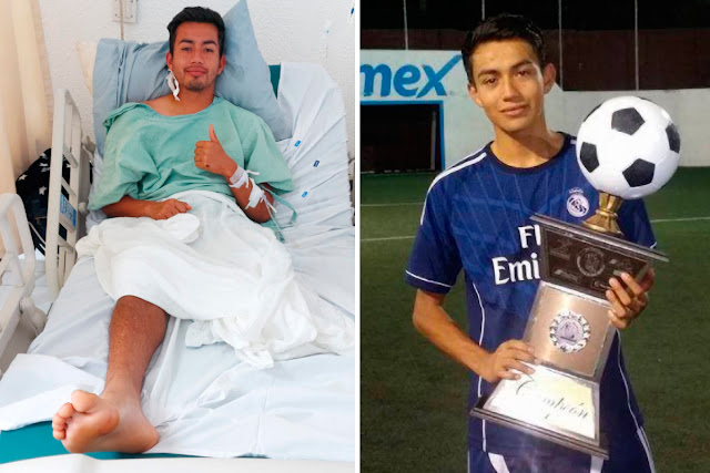 Mexican footballer, Rodrigo Alain Cuevas leg has been amputated after electric shock