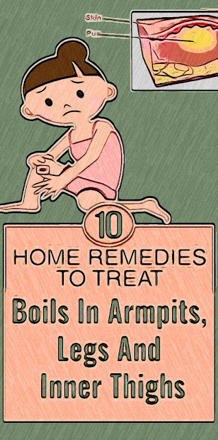 10 Quick Home Remedies To Cure Boils In Armpits Legs And Inner Thighs