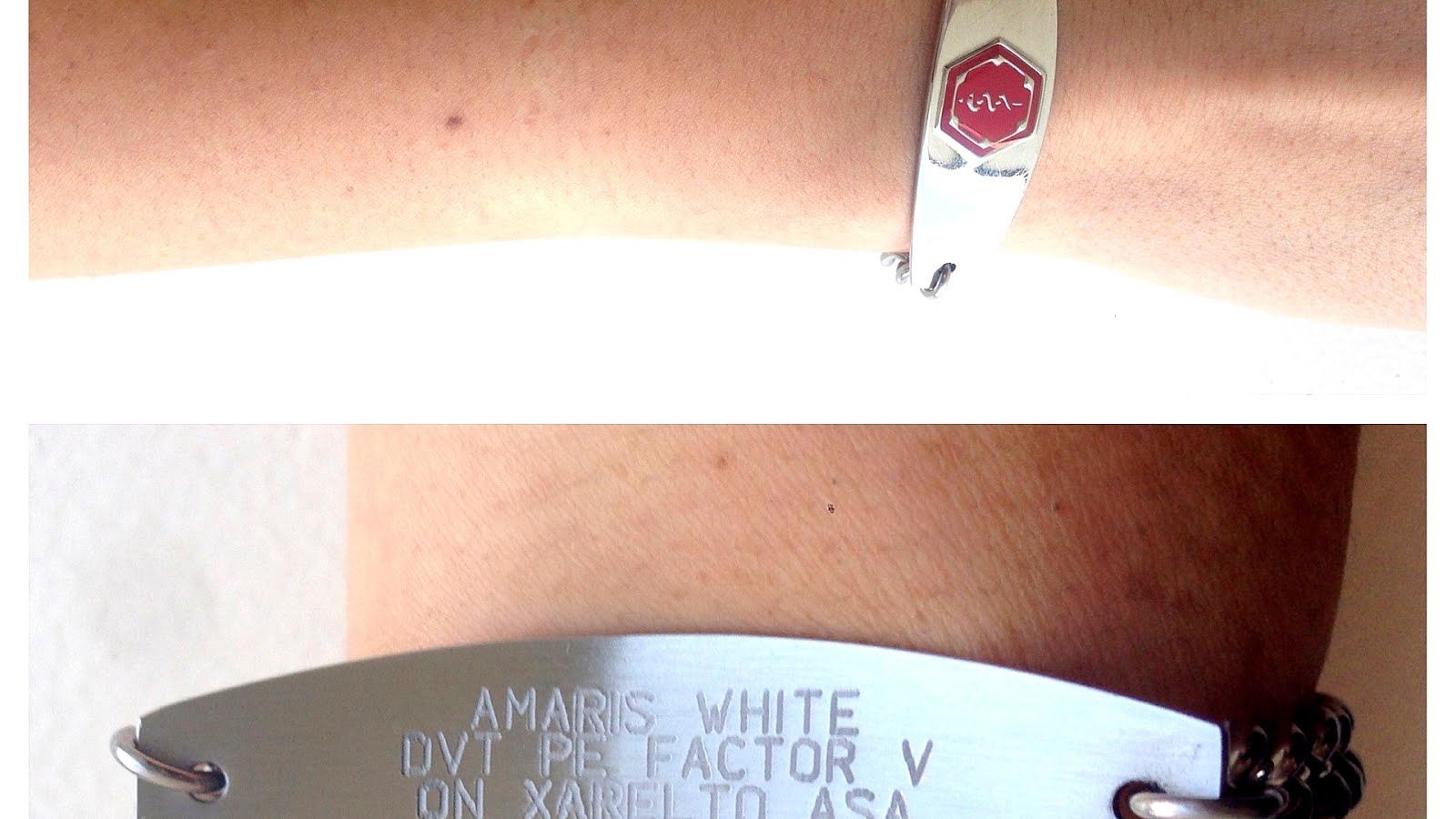 Blood Thinning Medication Xarelto Medi Choices