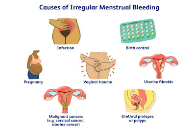 WHAT IS THE CAUSE OF PERIODS? 