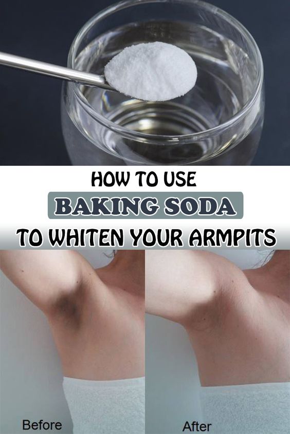 How to use baking soda to whiten your armpits Wellness Hero