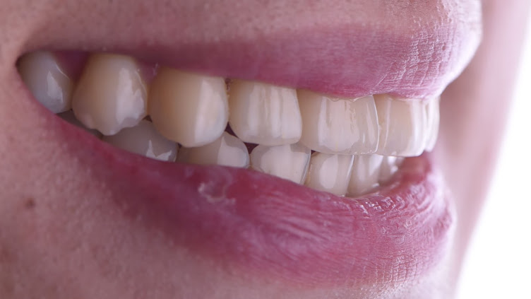 假牙科以及植牙科醫師江明學的部落格--Ming's blog