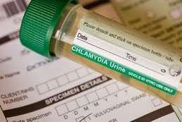 Chlamydia Urine Test Kit