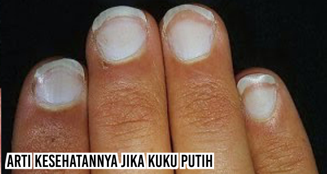 Ternyata Bentuk Dan Warna Kuku Menunjukkan Kesehatanmu Barang Promosi Mug Promosi Payung Promosi Pulpen Promosi Jam Promosi Topi Promosi Tali Nametag