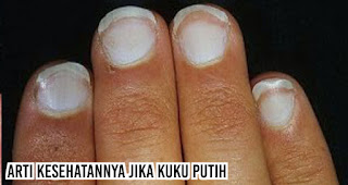 Arti kesehatannya jika Kuku putih