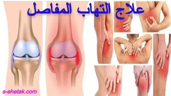 علاج التهاب المفاصل والعضلات