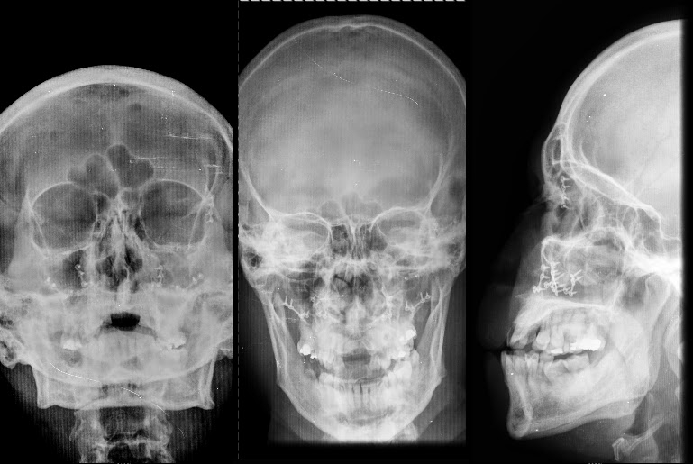 Radiologia septiembre 2012 Radiologia septiembre 2012