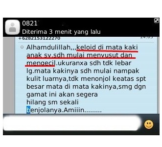 Cara Menyembuhkan Keloid Di Dada Dengan Cepat dan Efektif ~ TESTIMONI QNC JELLY GAMAT Cara Menyembuhkan Keloid Di Dada Dengan Cepat dan Efektif ~ TESTIMONI QNC JELLY GAMAT
