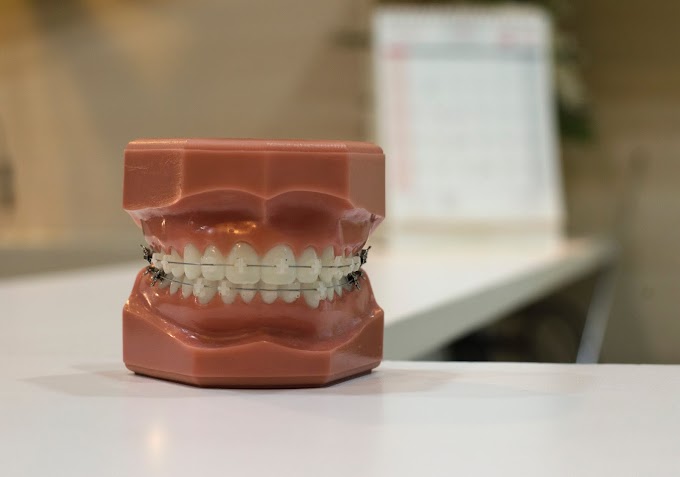 Dentist in Missouri city / U.S.A 