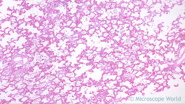 Microscopy image of viral pneumonia captured at 40x under the RB30 clinical lab microscope.