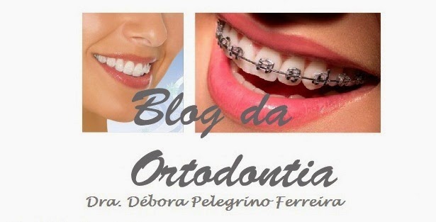 Blog da Ortodontia