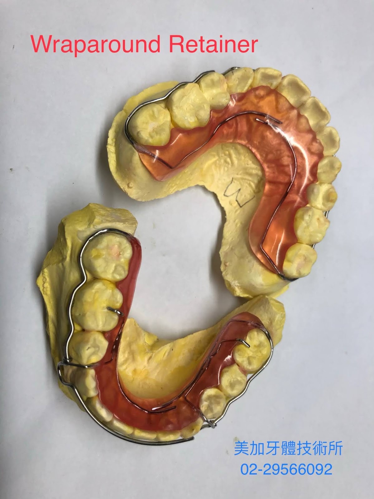 wraparound retainer