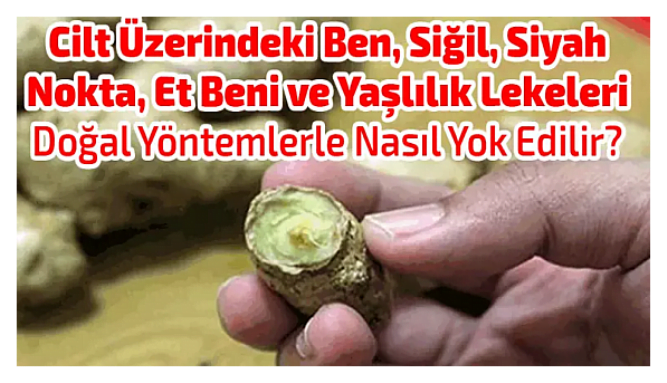 cilt uzerindeki ben sigil siyah nokta