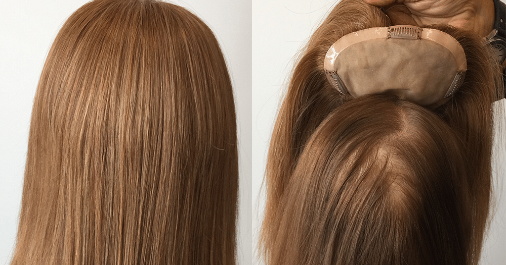How Are Wigs A Solution For Hair Loss