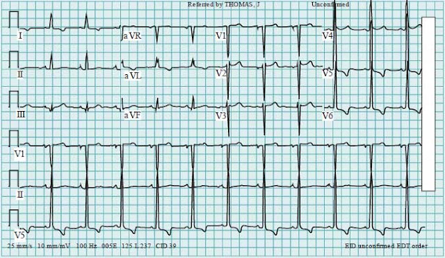 Presenting ECG