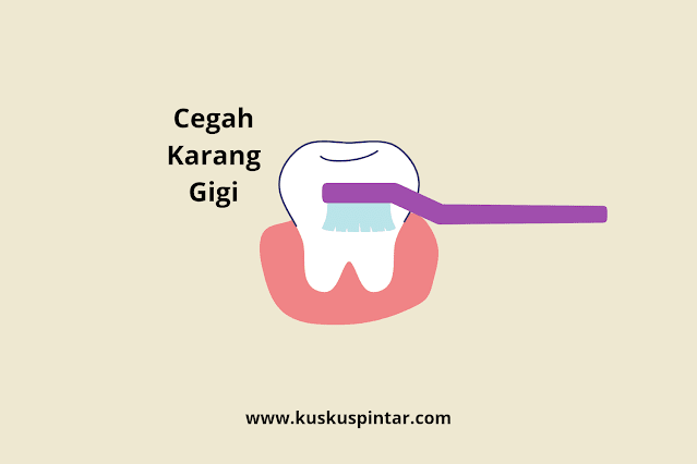 Bahaya Karang Gigi