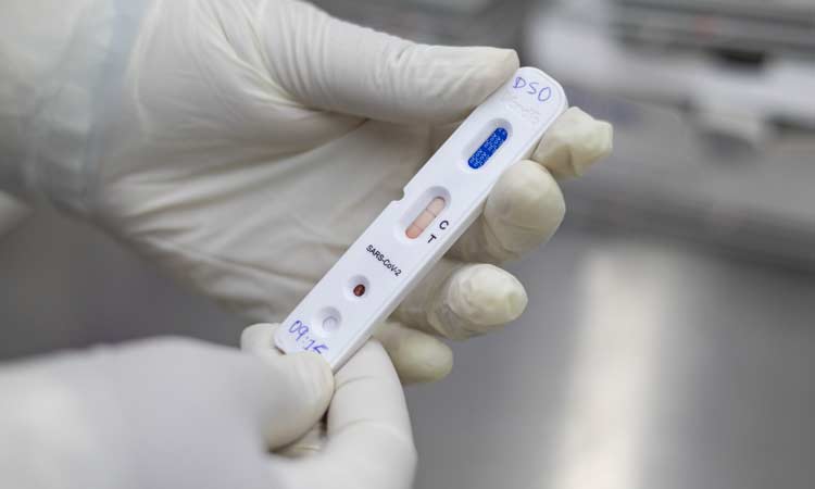 Bahia registra mais de 15 mil casos ativos da Covid-19