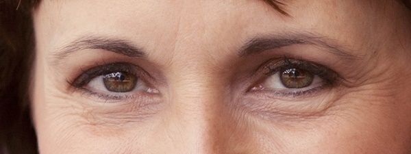 http://www.bhtips.com/2015/12/top-10-ways-to-remove-under-eye-wrinkles.html
