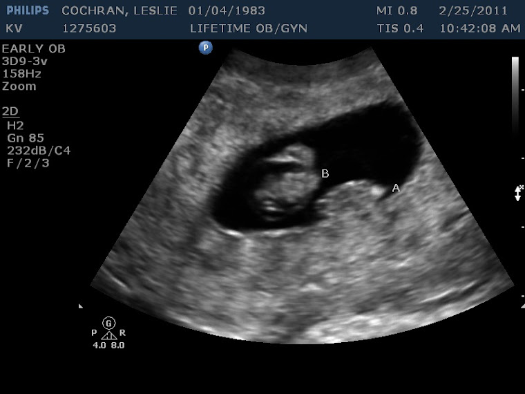 Journey to meeting Baby A and Baby B