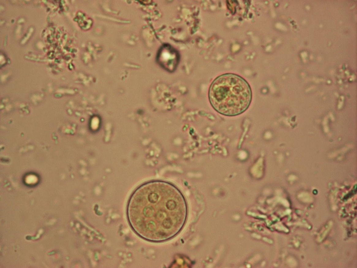 BIOLOGIA MOLECULAR PRUEBA CONFIRMATORIA DE AMEBIASIS