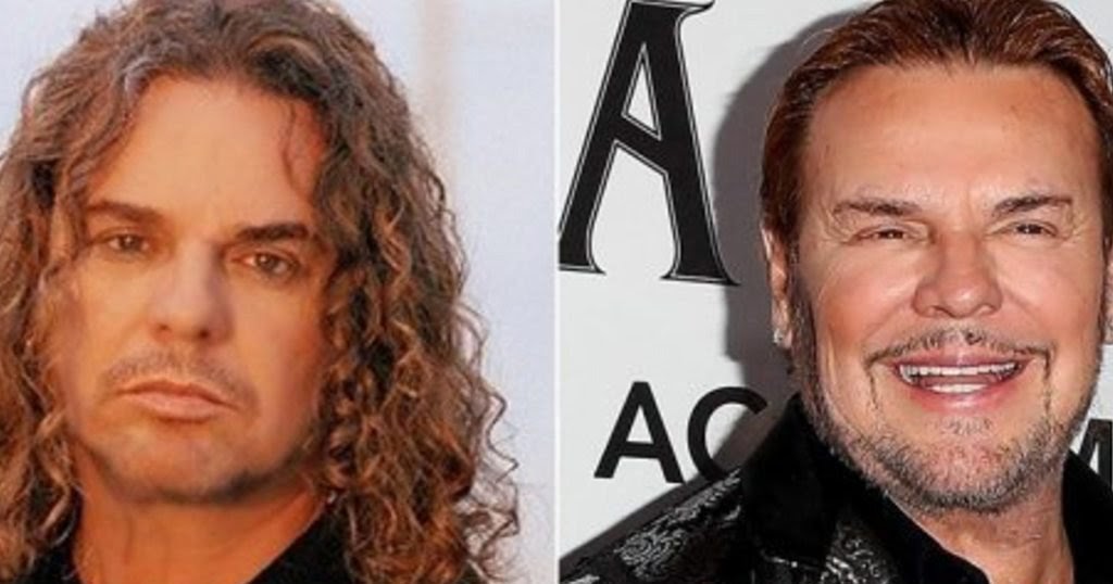 La cirugía estética del cantante de Maná Fotos de Famosos La cirugía estética del cantante de Maná Fotos de Famosos