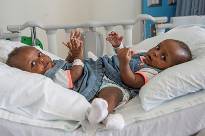 1ab Beautiful new photo of former conjoined Nigerian twins, Miracle and Testimony Ayeni (Photos)
