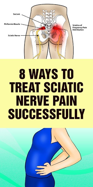 8 Easy ways to Treat Sciatic Nerve Pain Successfully