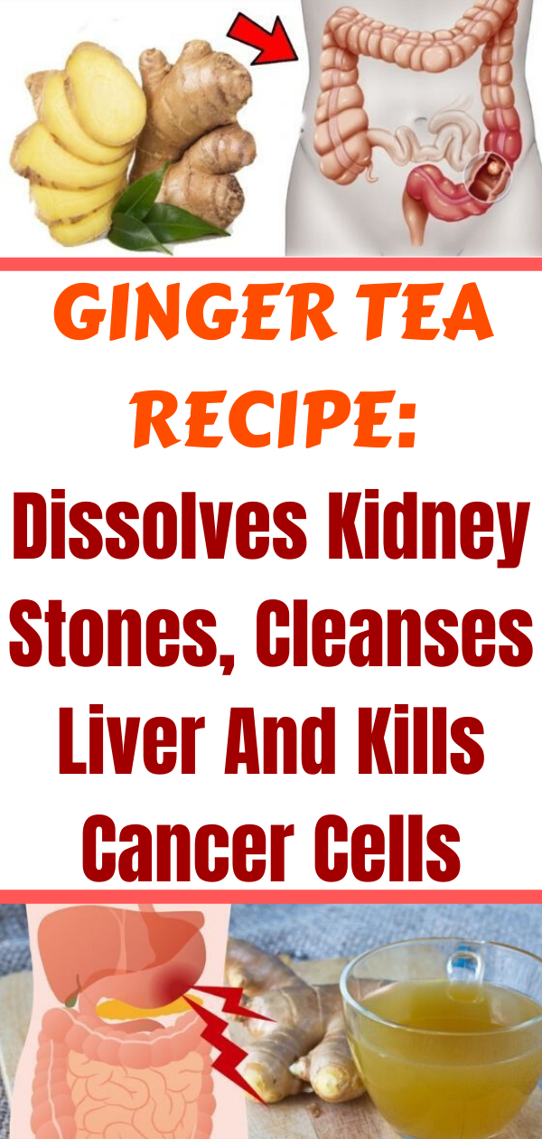 Ginger Tea Dissolves Kidney Stones, Cleanses Liver And Kills Cancer