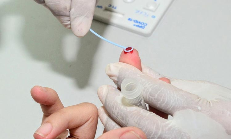 Bahia registra 53 óbitos por Covid-19 e mais 2.377 casos