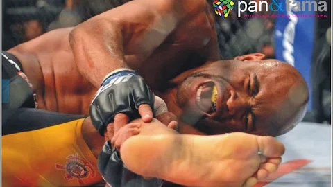 Ufc: La Fractura De Anderson Silva.