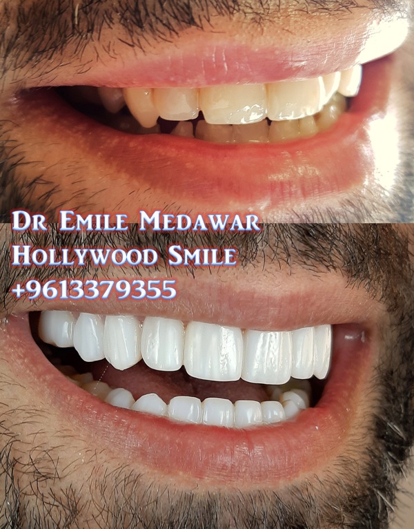 Dr Emile Medawar, Cosmetic Dentist, Dental Implants