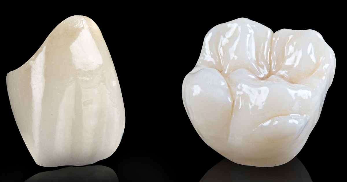 Dental FAQ All About Dental Crown (Cap, Cover) Dr. Bharat Katarmal