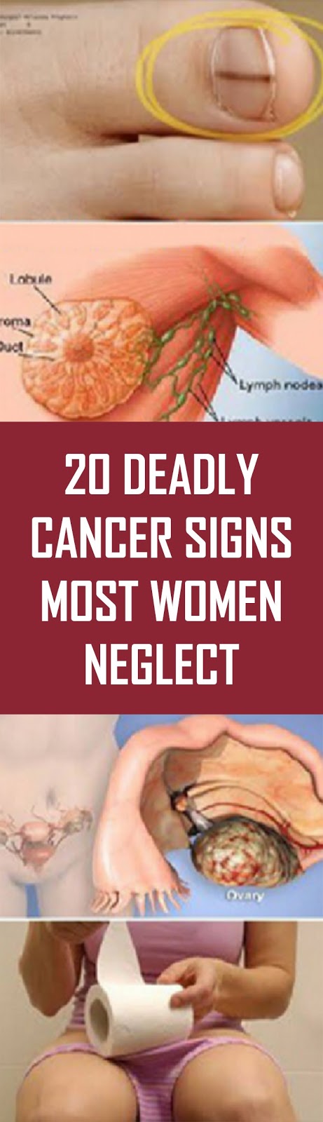 20 Deadly Cancer Signs Most Women Neglect Nutrition Health Tips