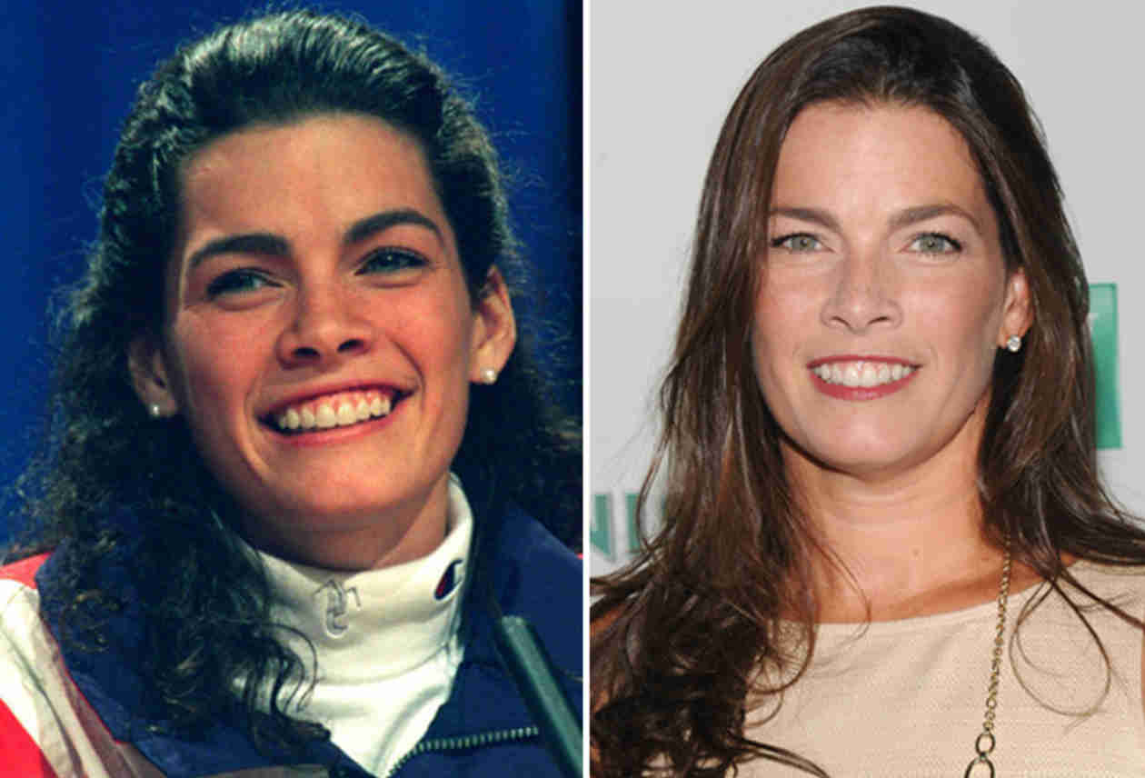 nancy kerrigan husband USA News Collections