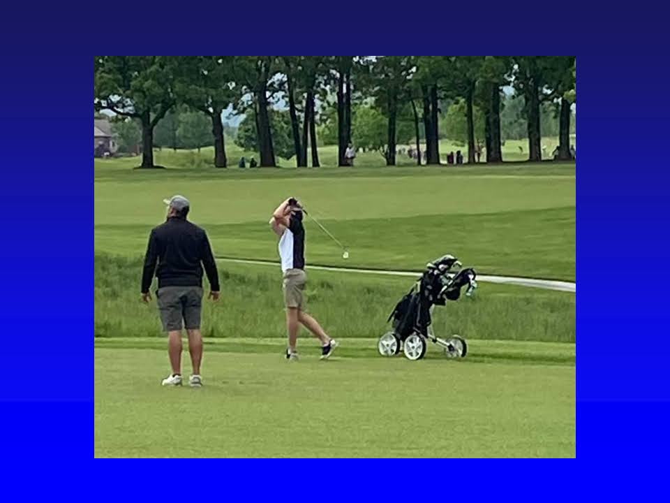 Sports after Posterior Spinal Fusion T2L2, 1 year postoperative