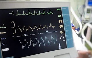 kematian di ruang icu perbedaan icu dan ugd harapan hidup pasien icu alat-alat di ruang icu berapa lama pasien di ruang icu indikasi pasien masuk ruang icu pengalaman dirawat di icu peraturan ruang icu