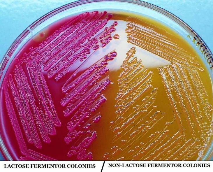MacConkey Agar Composition, Principle and Use PharmaSOPcorner