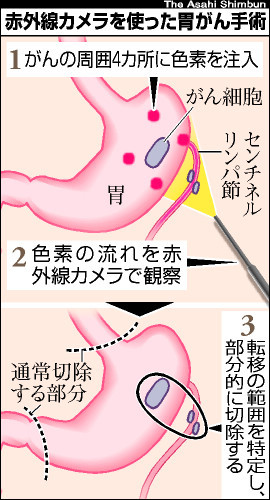 がん治療ニュース