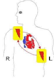 WHAT IS CPR ? WHAT IS CPR STAND FOR ? FULL FORM OF CPR ? CPR IN HINDI