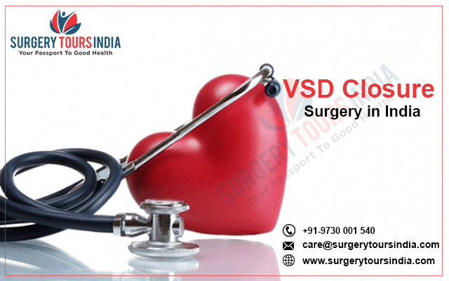 VSD Closure Surgery India
