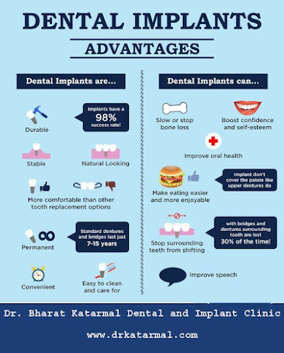 advantages of dental implant