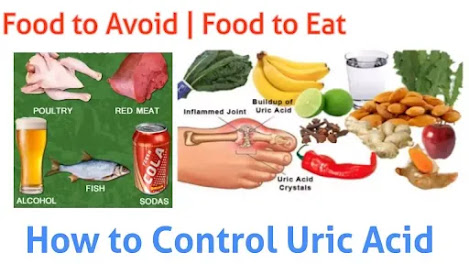 how to cure uric acid permanently