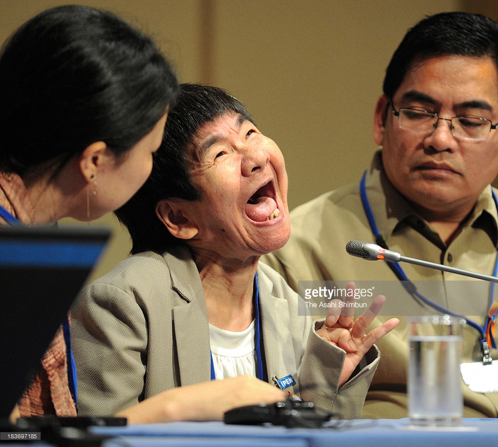 Dentosphere World Of Dentistry The Future Of Amalgam In