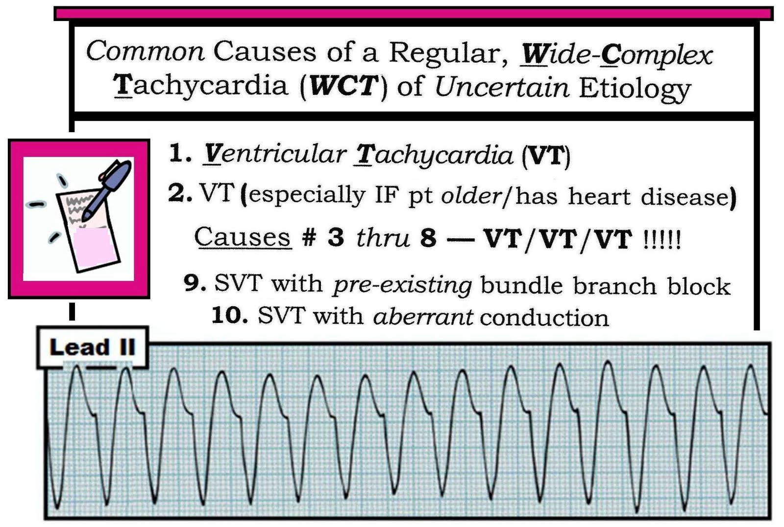 Benign Tachycardia Causes _ Inappropriate Sinus Tachycardia: Symptoms ...