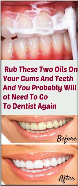 Rub These Two Oils On Your Gums And Teeth And You Proobably Will not Need to go to Dentist Again