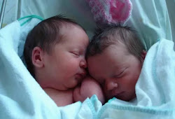 12 Arti Mimpi Melahirkan Anak Kembar Dalam Islam Primbon88 Com